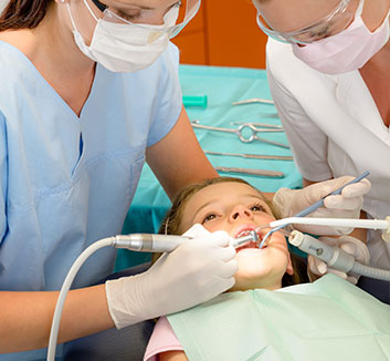 Composite Fillings