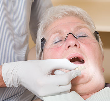 Dental Implants