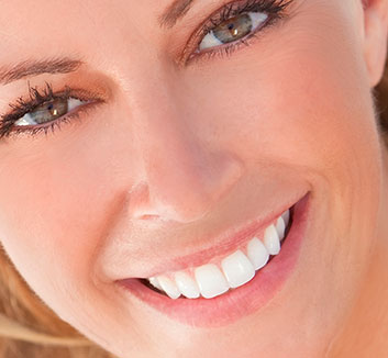Porcelain Veneers
