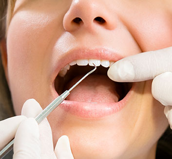 Dental Exams and Cleanings